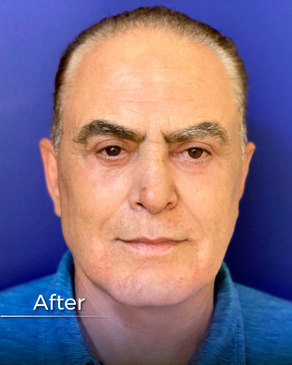 Slider image (9) Boroyan Plastic Surgery in Yerevan Armenia